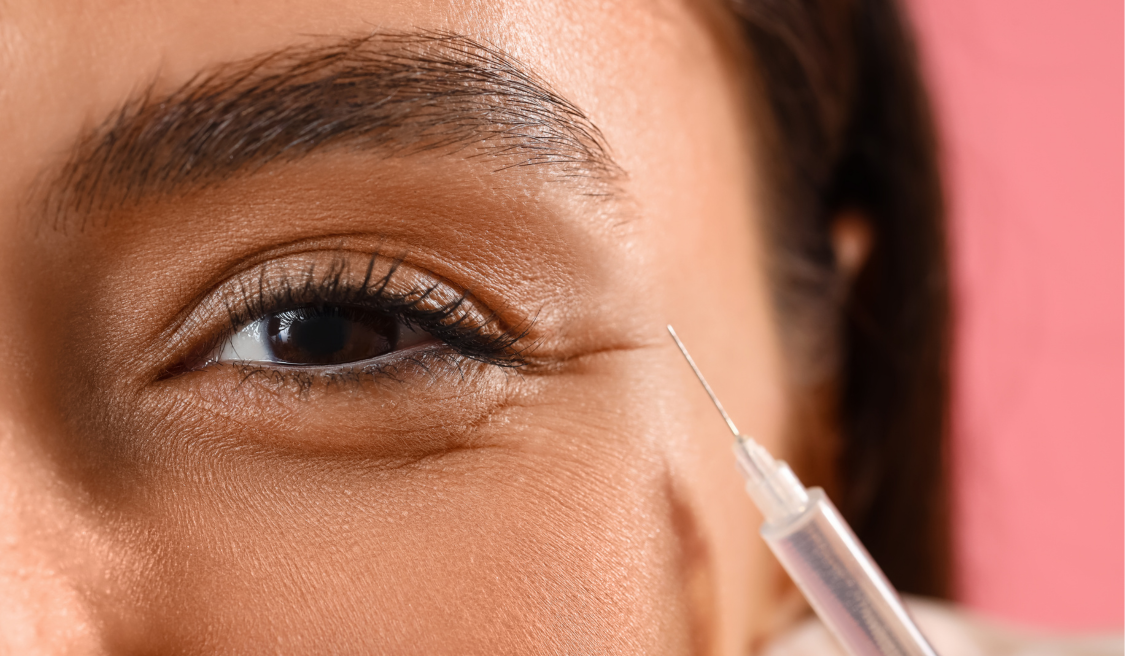 Dermal Fillers Under Your Eyes Vujevich Dermatology