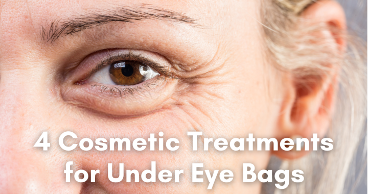 cosmetic treatments for under eye bags